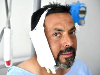 Public Defender Jaime Alvarez in a hospital room in Spain. AP photo.